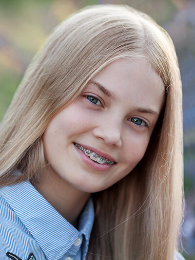 life with braces